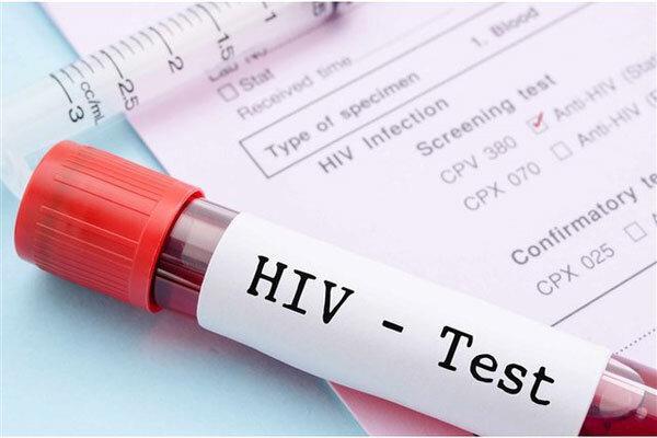185 نفر در چهارمحال و بختیاری به ویروس HIV مبتلا هستند 185 نفر در چهارمحال و بختیاری به ویروس HIV مبتلا هستند