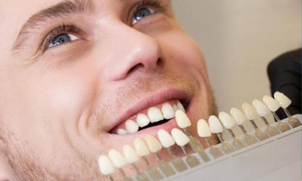 تفاوت بین روکش دندان و لمینت دندان