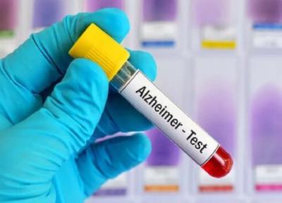 تشخیص آلزایمر به وسیله نوعی آزمایش خون