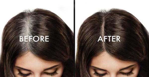 علل و راه های طبیعی درمان سفیدی مو ، قسمت اول