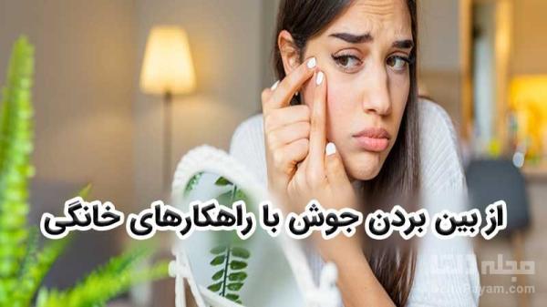 با چند راهکار خانگی جوش های خود را نابود کنید با چند راه چاره خانگی جوش های خود را نابود کنید